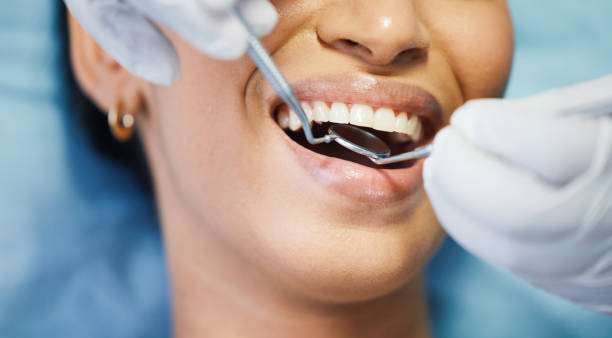 Best Root Canal Treatment  in Rio Vista, TX